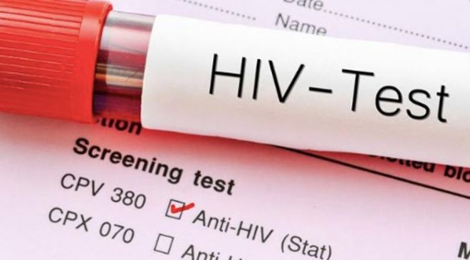 Risky: 1,072 Ghanaians Test HIV Positive In Tema