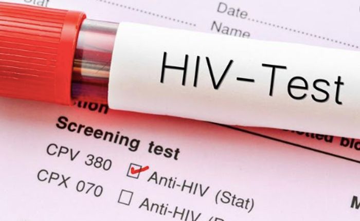 Risky: 1,072 Ghanaians Test HIV Positive In Tema