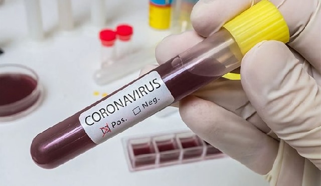 Tamale: COVID-19 positive Guinean woman escapes from quarantine centre