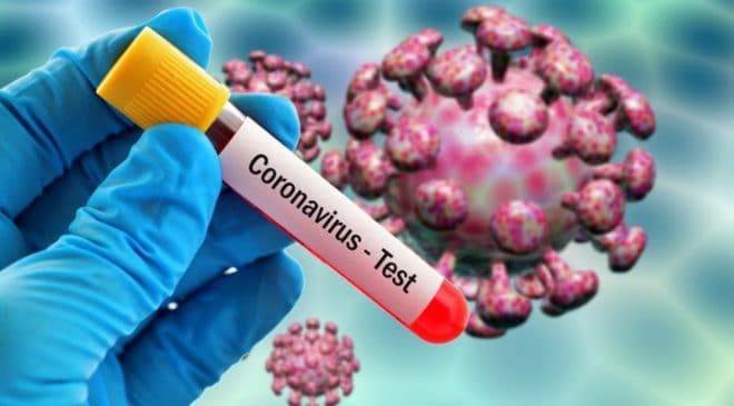 Ghana’s coronavirus cases jump to 68