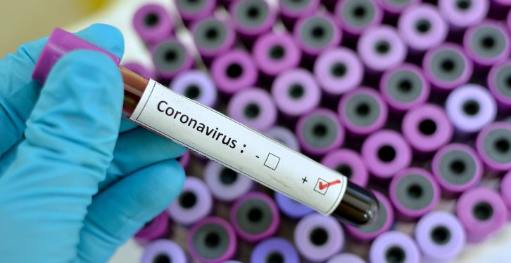 Noguchi investigating another suspected case of Coronavirus at Korle Bu